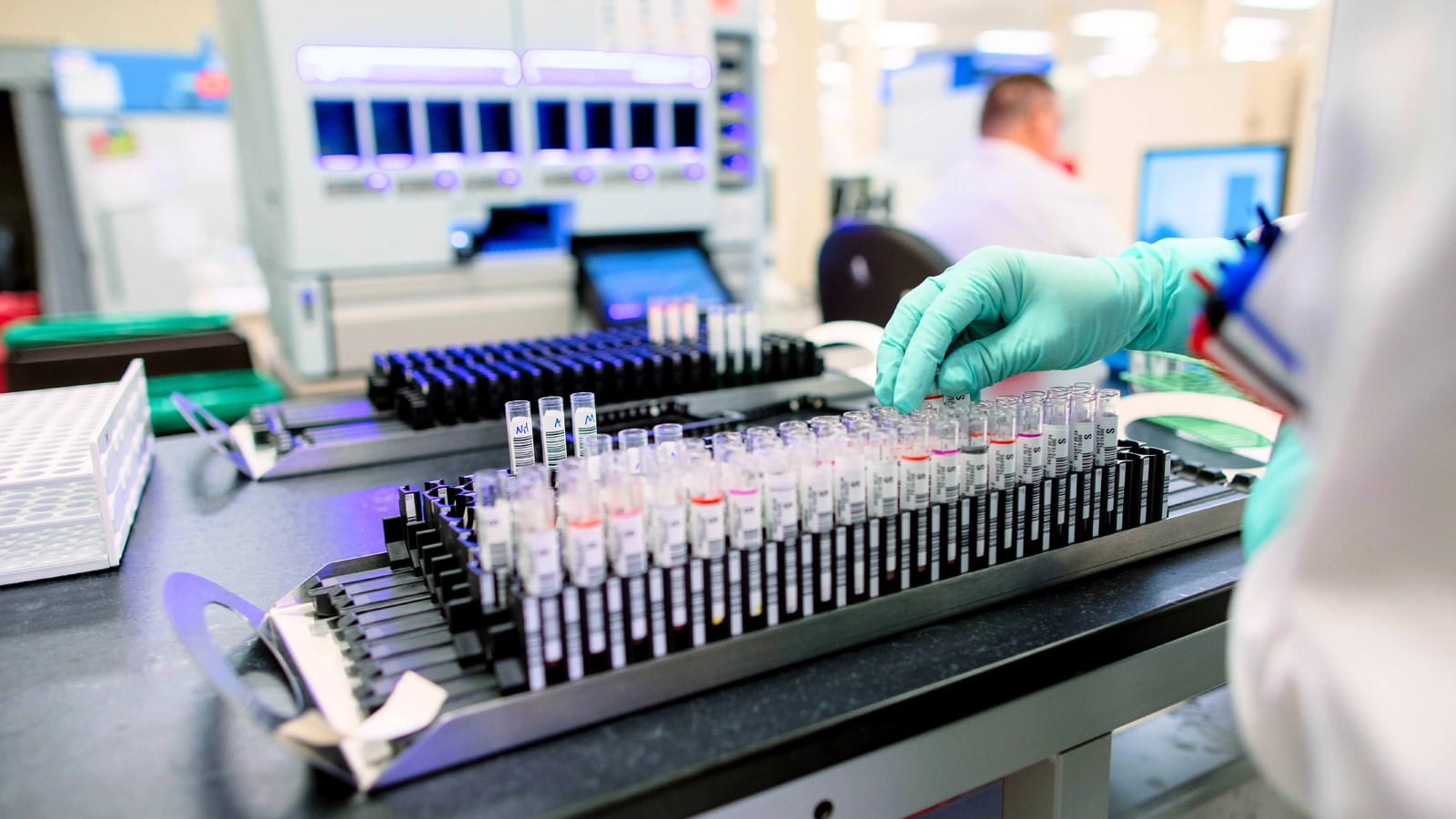 A Closer Look at Biochemistry Testing